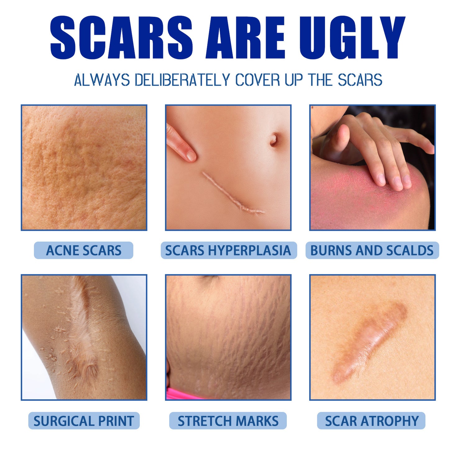 Scar Repair Cream