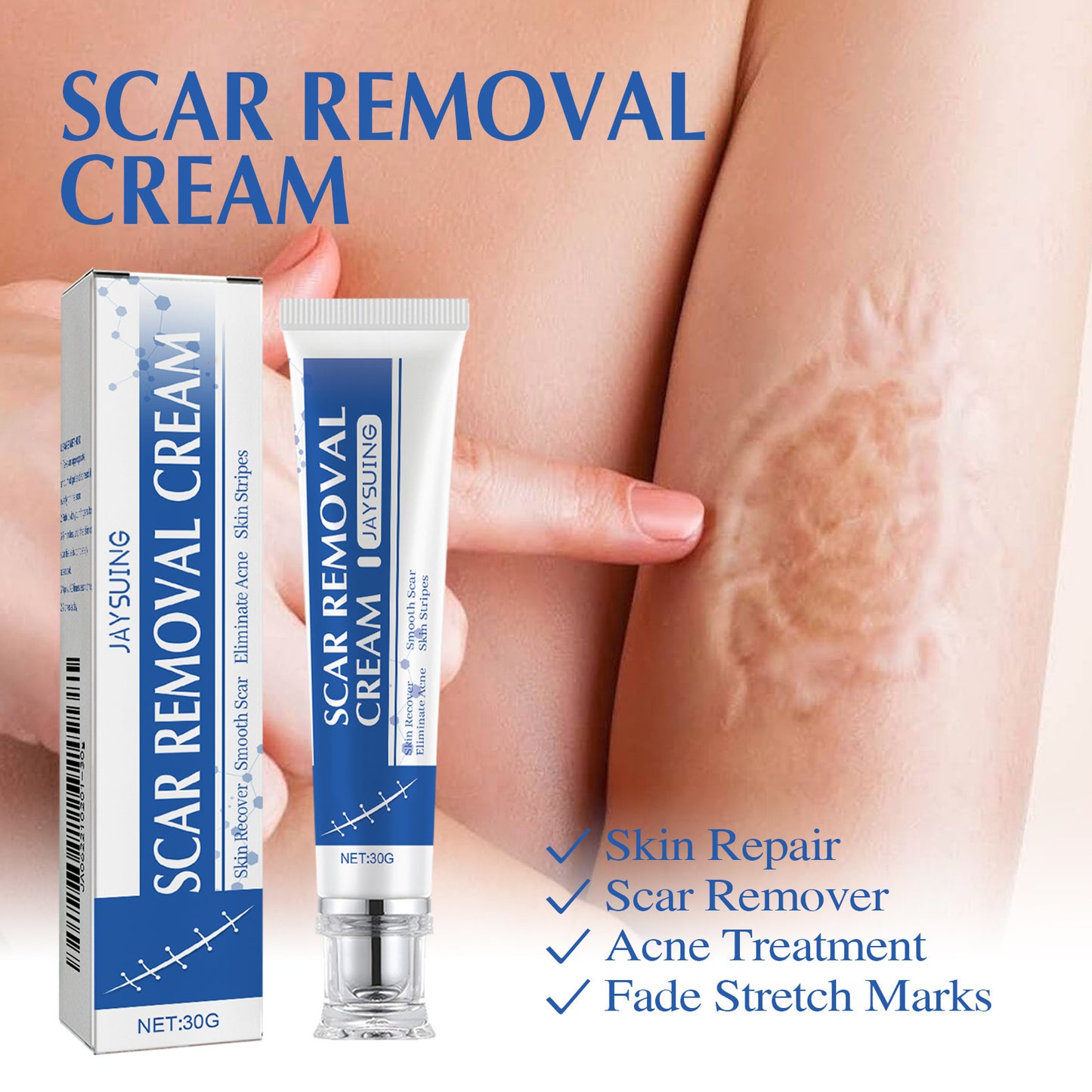 Scar Repair Cream